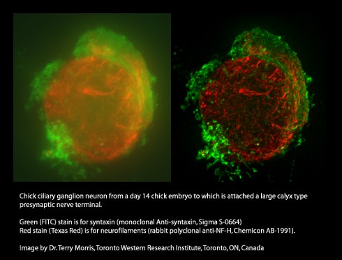 Before/AFter deconvolution - Color