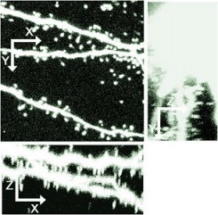 Confocal Before Deconv