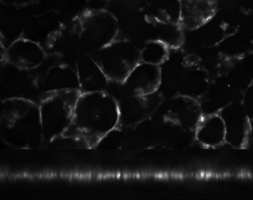 Deconvolved with spherical aberration compensation