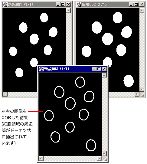 周辺領域を抽出