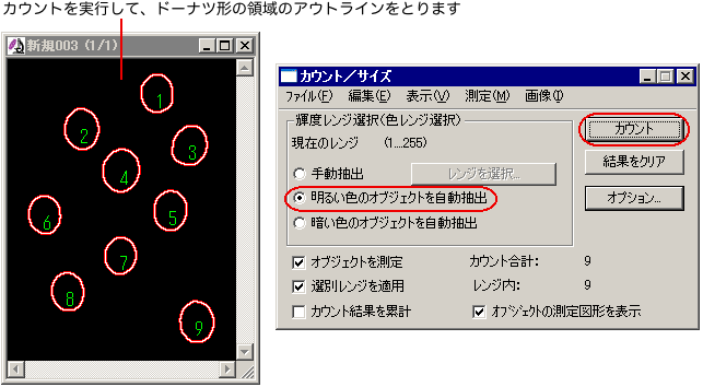周辺領域のアウトラインをとる