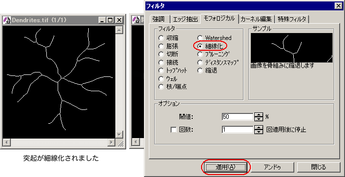 突起を細線化